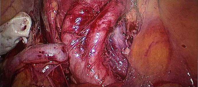 12fbe1ead1d122d9f6ebe34007683a6