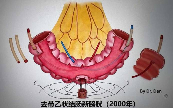 be8a32658afa06857c5dda68e1ebf38